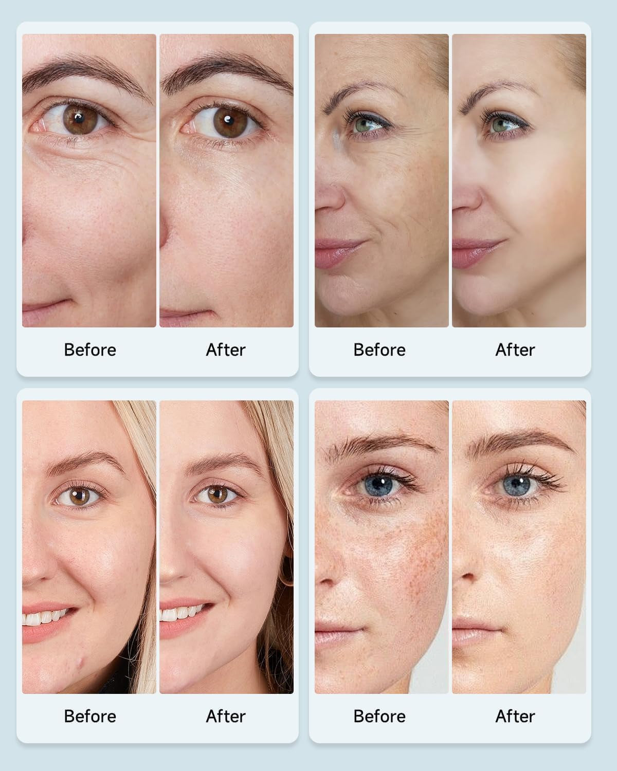 LED Face Mask — Light Therapy for Skincare